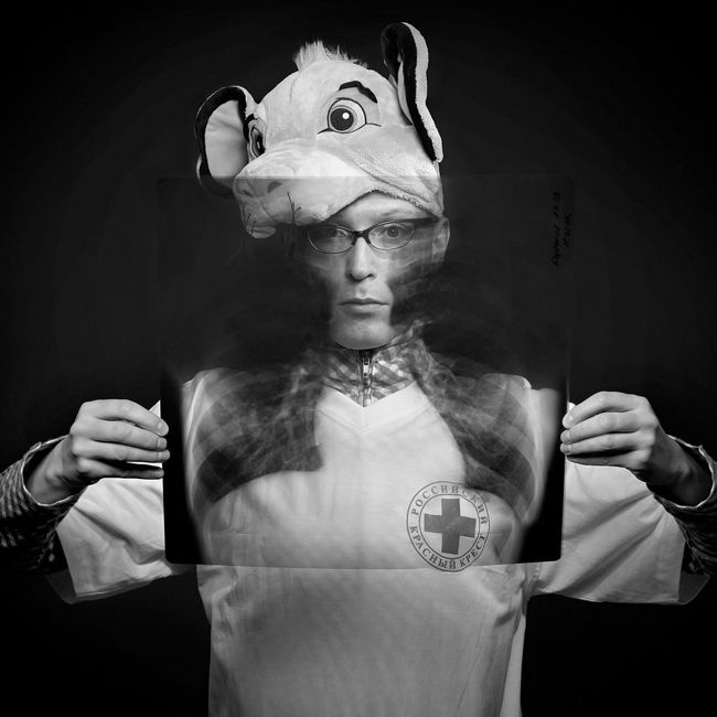 Андрей Бартенев со снимком собственных лёгких. Проект «Твоё Здоровье в Твоих Руках»